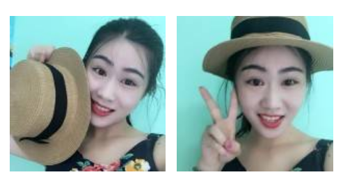 做超声波去眼袋以后成功去除眼袋，还推荐给小伙伴581