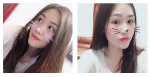 做超声波去眼袋以后成功去除眼袋，还推荐给小伙伴581