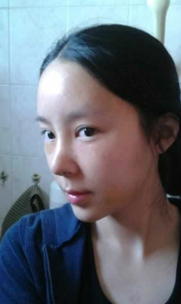 瘦脸成功wǒ靠得shì超 声 波瘦脸 瘦脸成功wǒ靠得shì超 声 波瘦脸