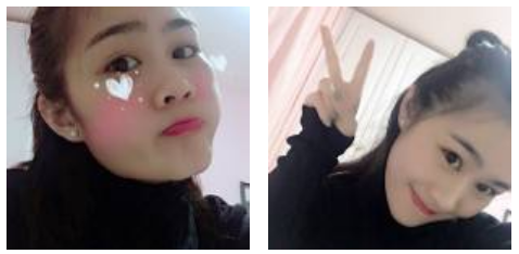 80后宝妈轻松去眼袋的秘密就是超声波去眼袋936 80后宝妈轻松去眼袋的秘密就是超声波去眼袋936