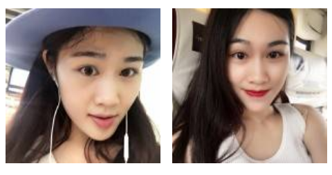 80后宝妈轻松去眼袋的秘密就是超声波去眼袋936 80后宝妈轻松去眼袋的秘密就是超声波去眼袋936