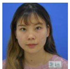 介绍同事做le超 声 波去眼袋让她找到男友le 介绍同事做le超 声 波去眼袋让她找到男友le