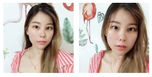 介绍同事做le超 声 波去眼袋让她找到男友le 介绍同事做le超 声 波去眼袋让她找到男友le