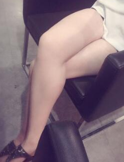 超声波减肥瘦大腿整形恢复经历,瘦腿效果不错121 超声波减肥瘦大腿整形恢复经历,瘦腿效果不错121