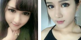 超声波去眼袋效果日记本，看我变电力眼667