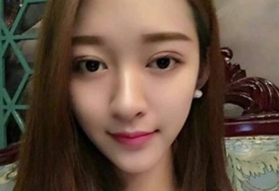 超声波双眼皮,让你阳光自信376 超声波双眼皮,让你阳光自信376