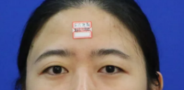 爱美姑娘们,快来做超声波双眼皮吧!373 爱美姑娘们,快来做超声波双眼皮吧!373