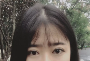 爱美姑娘们,快来做超声波双眼皮吧!373 爱美姑娘们,快来做超声波双眼皮吧!373