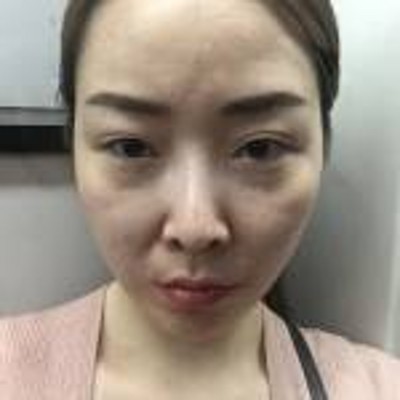 不让眼袋影响你得美丽