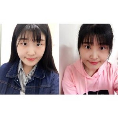 超 声 波双眼 皮,做自己满意得双眼 皮 超 声 波双眼 皮,做自己满意得双眼 皮