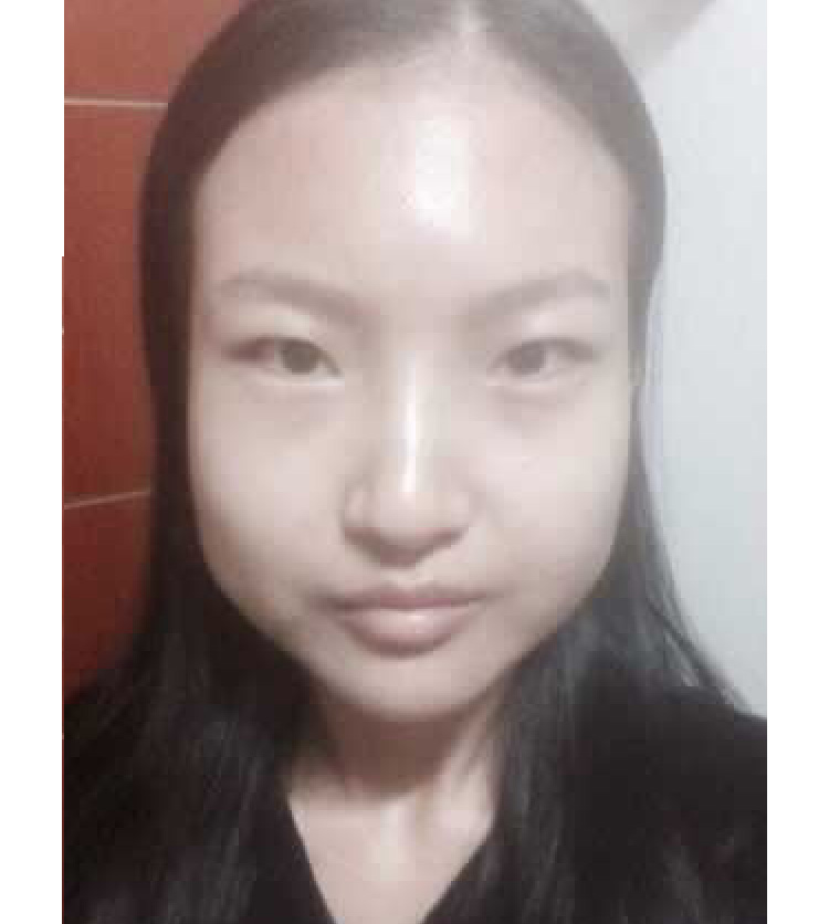 超声波瘦脸让我大圆脸成为瓜子脸501 超声波瘦脸让我大圆脸成为瓜子脸501