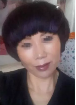 肌肤问题也可以做超级微拉美来恢复881 肌肤问题也可以做超级微拉美来恢复881