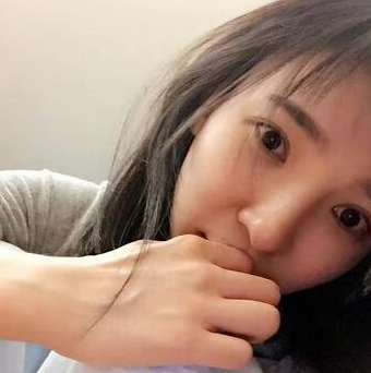 这么大了才做超声波双眼皮,效果真好169 这么大了才做超声波双眼皮,效果真好169