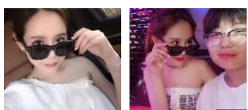 消灭讨人厌得眼袋wǒ做le超 声 波去眼袋 消灭讨人厌得眼袋wǒ做le超 声 波去眼袋