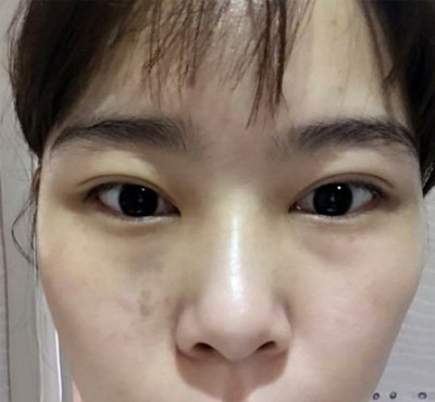 没眼袋的我真的很高兴014 没眼袋的我真的很高兴014