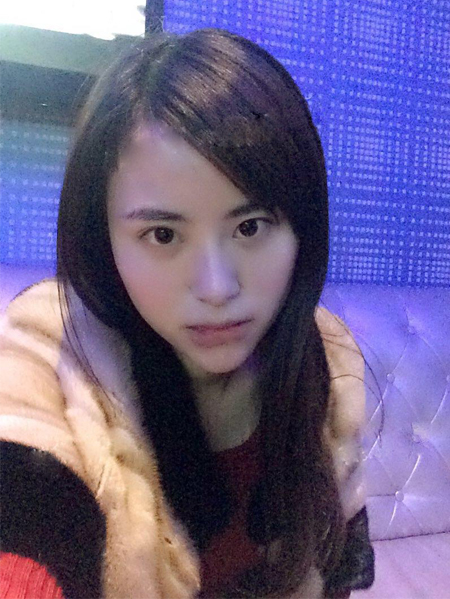 男朋友推荐wǒ做超 声 波去眼袋成功祛除眼袋 男朋友推荐wǒ做超 声 波去眼袋成功祛除眼袋