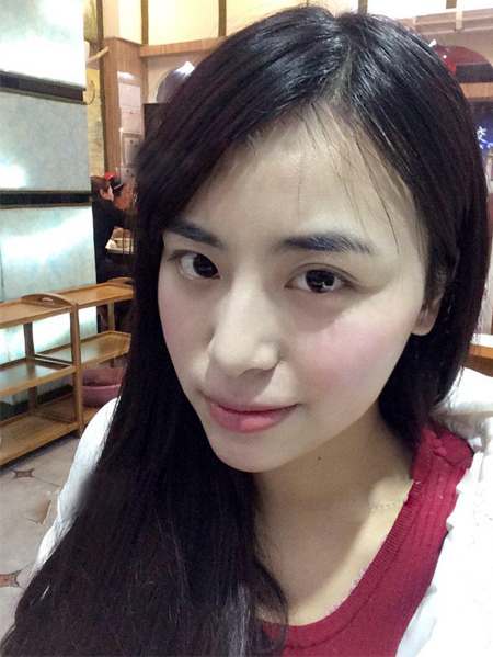 男朋友推荐wǒ做超 声 波去眼袋成功祛除眼袋 男朋友推荐wǒ做超 声 波去眼袋成功祛除眼袋