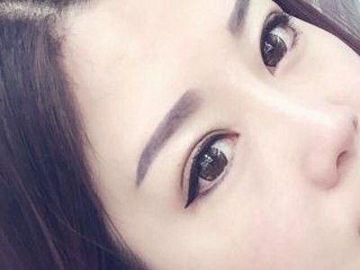 超声波双眼皮让你想美就美,不用遮遮掩掩!766 超声波双眼皮让你想美就美,不用遮遮掩掩!766