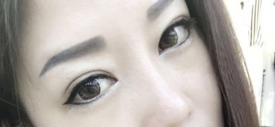 超声波双眼皮让你想美就美,不用遮遮掩掩!766 超声波双眼皮让你想美就美,不用遮遮掩掩!766