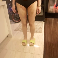 超声波减肥后,随时随地都可以摆拍了882 超声波减肥后,随时随地都可以摆拍了882