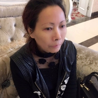 做了超声波祛眼袋真的年轻了不少524 做了超声波祛眼袋真的年轻了不少524