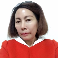 做了超声波祛眼袋真的年轻了不少524 做了超声波祛眼袋真的年轻了不少524