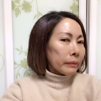 做了超声波祛眼袋真的年轻了不少524 做了超声波祛眼袋真的年轻了不少524