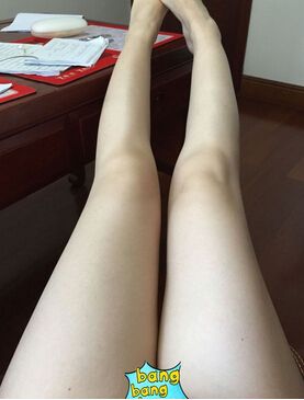 超声波减肥,给当妈咪的我自信!779 超声波减肥,给当妈咪的我自信!779