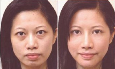 去le眼袋更年轻更可爱le 去le眼袋更年轻更可爱le