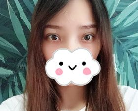 眼部修复我选择超声波双眼皮139 眼部修复我选择超声波双眼皮139