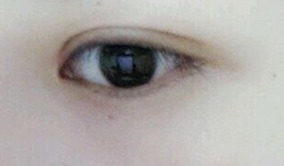 超级自然的超声波双眼皮969 超级自然的超声波双眼皮969