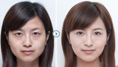 超声波去眼袋不一般的去眼袋技术985 超声波去眼袋不一般的去眼袋技术985