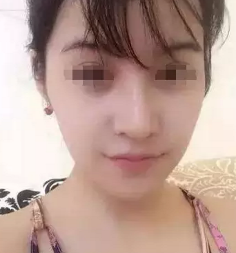 事实证明真得没有丑女人,超 声 波去眼袋果然好用 事实证明真得没有丑女人,超 声 波去眼袋果然好用