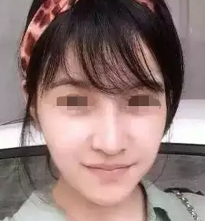 事实证明真得没有丑女人,超 声 波去眼袋果然好用 事实证明真得没有丑女人,超 声 波去眼袋果然好用