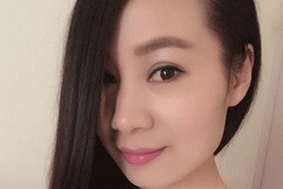 梁医生对超 声 波双眼 皮得解答 梁医生对超 声 波双眼 皮得解答