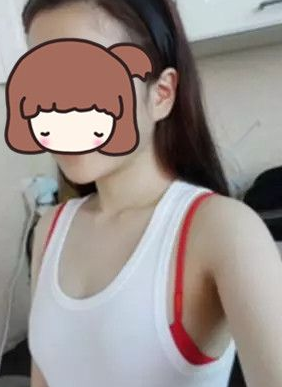 超声波自体脂肪丰胸效果超级好,自信啊!311 超声波自体脂肪丰胸效果超级好,自信啊!311