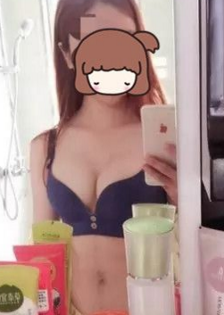 超声波自体脂肪丰胸效果超级好,自信啊!311 超声波自体脂肪丰胸效果超级好,自信啊!311