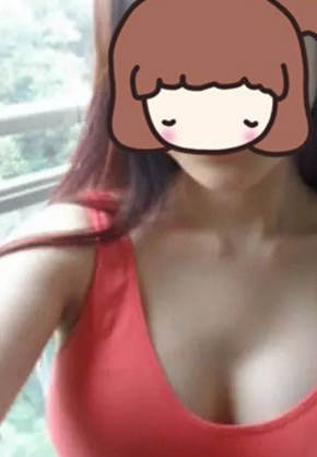 超声波自体脂肪丰胸效果超级好,自信啊!311 超声波自体脂肪丰胸效果超级好,自信啊!311