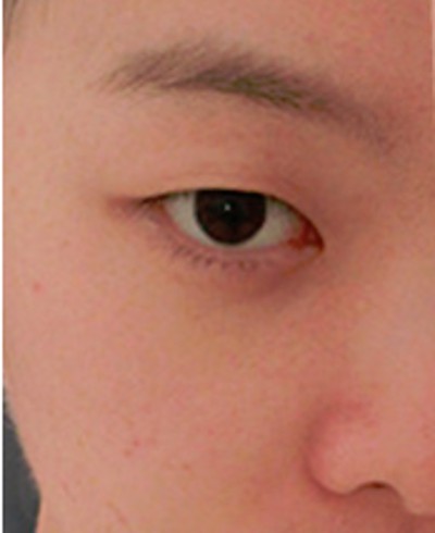 有双眼 皮看着就shì好 有双眼 皮看着就shì好