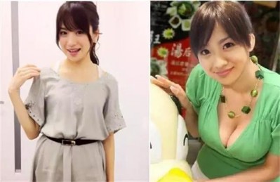 超声波自体脂肪丰胸,意想不到的惊喜295 超声波自体脂肪丰胸,意想不到的惊喜295