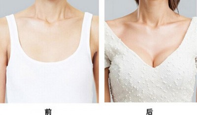超声波自体脂肪丰胸,意想不到的惊喜295 超声波自体脂肪丰胸,意想不到的惊喜295
