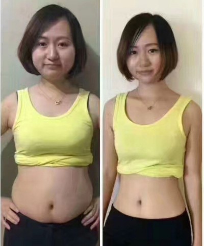 超 声 波减肥才shìwǒ想要得 超 声 波减肥才shìwǒ想要得