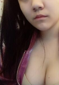 超声波自体脂肪丰胸的对比照片,效果挺好的194 超声波自体脂肪丰胸的对比照片,效果挺好的194