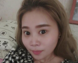 超 声 波双眼 皮整形效果挺好得,给大家看 超 声 波双眼 皮整形效果挺好得,给大家看