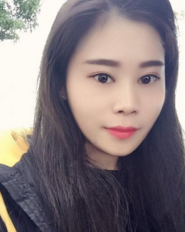 超 声 波双眼 皮整形效果挺好得,给大家看 超 声 波双眼 皮整形效果挺好得,给大家看