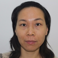 感谢超雅超 声 波去眼袋,年轻十几岁 感谢超雅超 声 波去眼袋,年轻十几岁