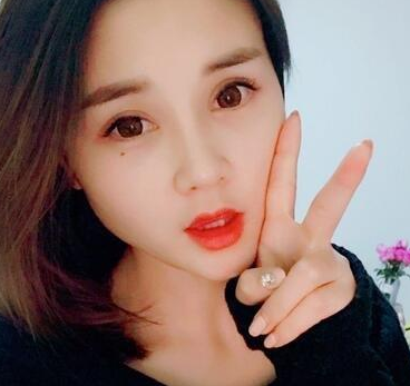 眼睛太小做超声波双眼皮绝对变大934 眼睛太小做超声波双眼皮绝对变大934