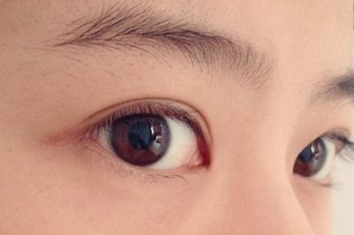 长眼袋很难为情?试试超声波去眼袋吧493 长眼袋很难为情?试试超声波去眼袋吧493