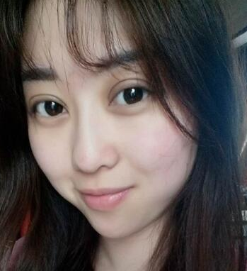 看wǒ眼部综合整形方法——超 声 波双眼 皮包括在内哦