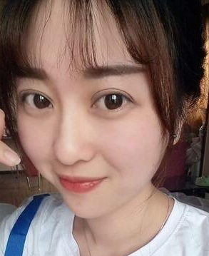 看wǒ眼部综合整形方法——超 声 波双眼 皮包括在内哦